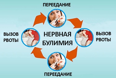 Лечение булимии в Голой Пристани
